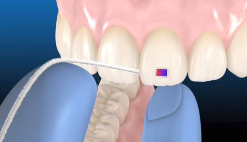 Seda o hilo dental