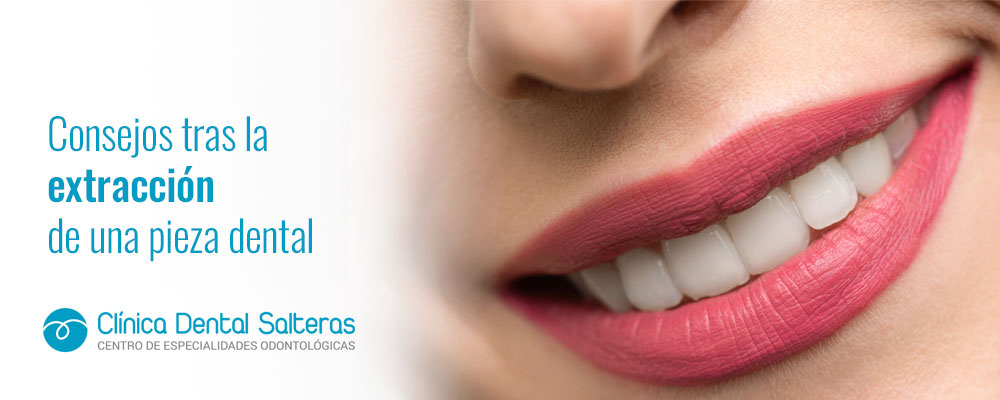 Consejos tras la extracción de una pieza dental